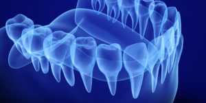 digital print of a lower jaw