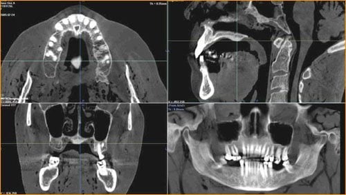 CT Scans, Richmond VA